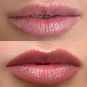 lippigmentatie+lip+blush+genezen+1.1