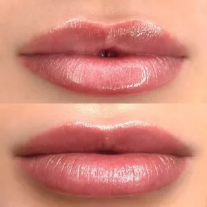 lippigmentatie+lip+blush+genezen+3.1