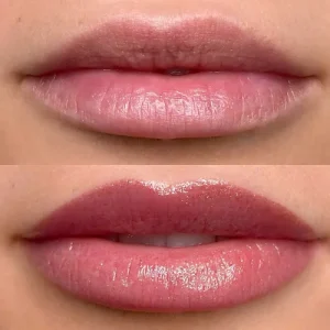 lippigmentatie+lip+blush+genezen+4.1